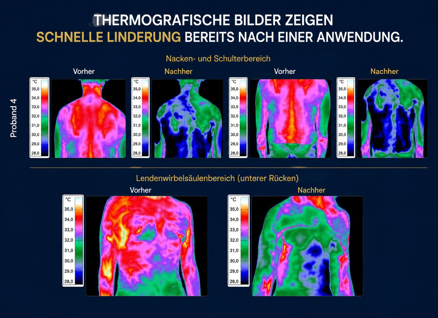 Thermografische Darstellung – ASEA REDOXGold Thermografische Vergleichsbilder zur Anwendung von ASEA REDOXGold Massage + Cooling Gel.